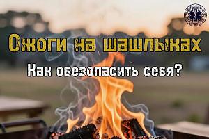 Что делать, если вы обожглись на шашлыках?